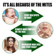 Mite Killer Spray Harmless