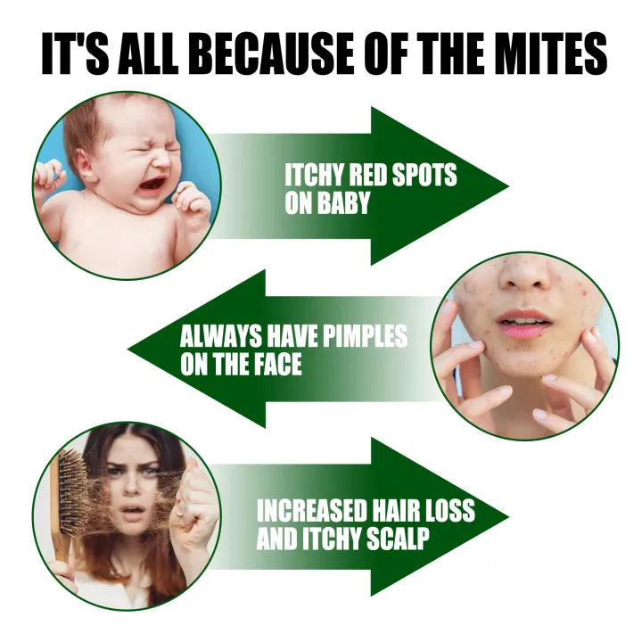 Mite Killer Spray Harmless